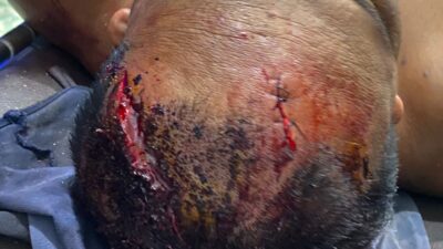 Ali Murdani Manurung Diborgol dalam Kondisi Luka Parah, Kuasa Hukum: “Ini Sudah Melampaui Batas”